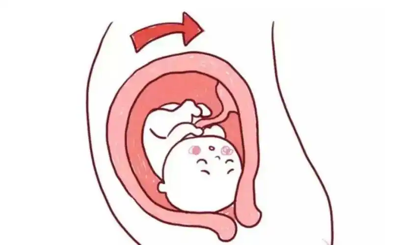 胎儿入盆的这些症状,宝宝悄悄告诉你,ta准备要出来啦_运动