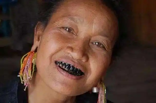 人们都说槟榔吃多了,成瘾戒不掉.