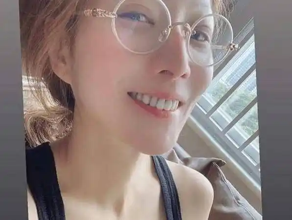 48岁郑秀文把自己背部刮痧的照片大方分享出来,网友纷纷表示:看着真是