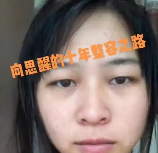 网红项思醒众多旧照曝光!整容之前就是一个普通素人