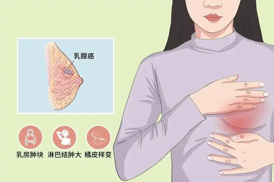 摸到乳房肿块不要慌!出现这4种情况才是乳腺癌