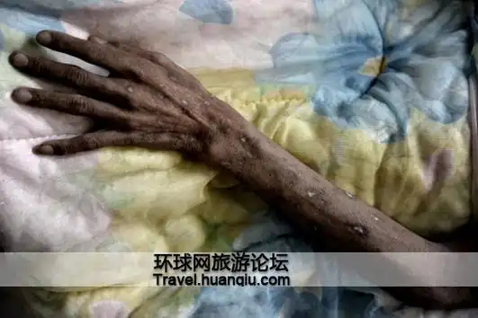 泰国收留艾滋病患者的寺庙组图