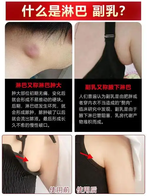 艾灸夜下淋巴结消贴腋下脖子疏通滚动仪器去副护膝