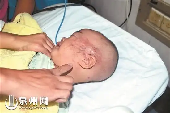 11月大宝宝被压车轮下 众人13秒抬车救人_凤凰资讯