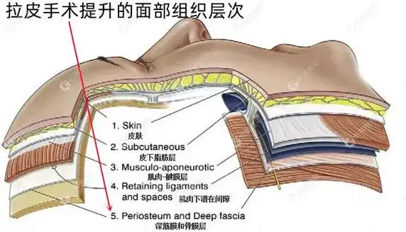 拉皮手术能提升到面部的深筋膜层