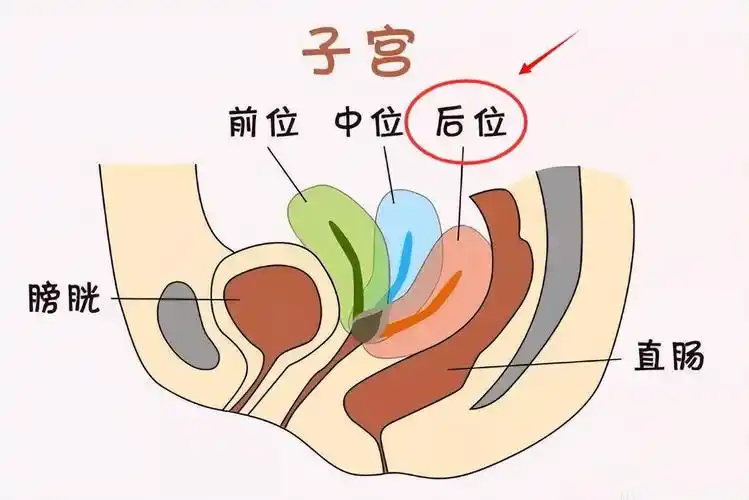怀孕是宫颈口位置改变的原因,因为子宫后位的女性的宫颈口是上翘的