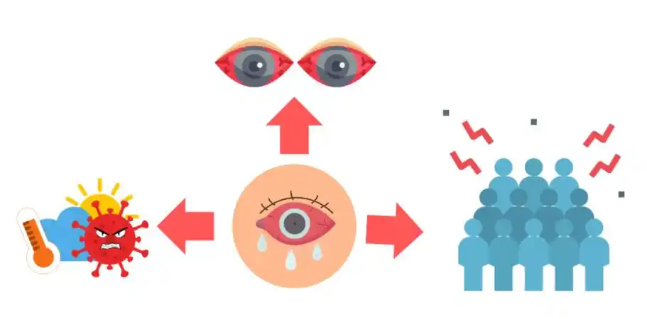 眼红眼痛视力模糊警惕红眼病