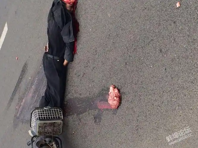 拉丝桥发生一场血腥的车祸被爆头了