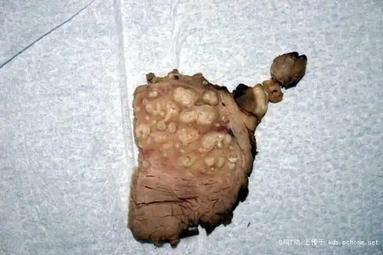 然后隔天我请教了学长   学长看了看就说这看起来很像感染了猪肉绦虫