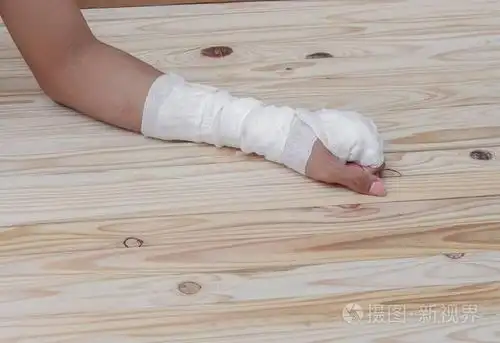 纱布绷带的手挫伤.治疗病人