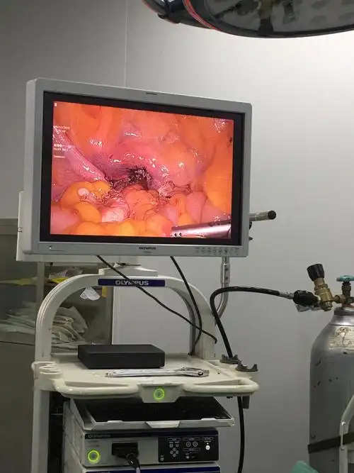 腹腔镜下子宫全切除术 妇科