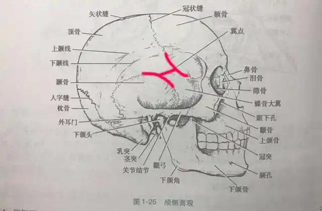 从解剖上看,"太阳穴"对应的位置几乎可以说是在额骨,顶骨,颞骨和蝶骨