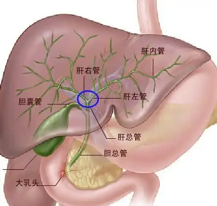 胆囊|腹痛|腹胀_网易订阅