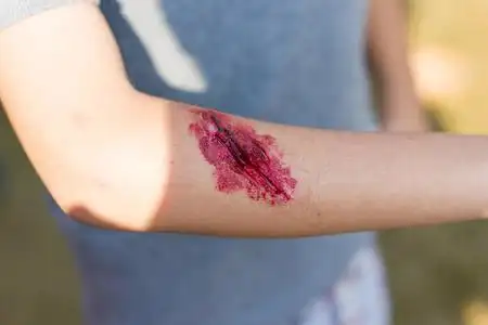 对男孩亚洲的手臂上的假伤, 着装伤口特效, 选择性对焦照片