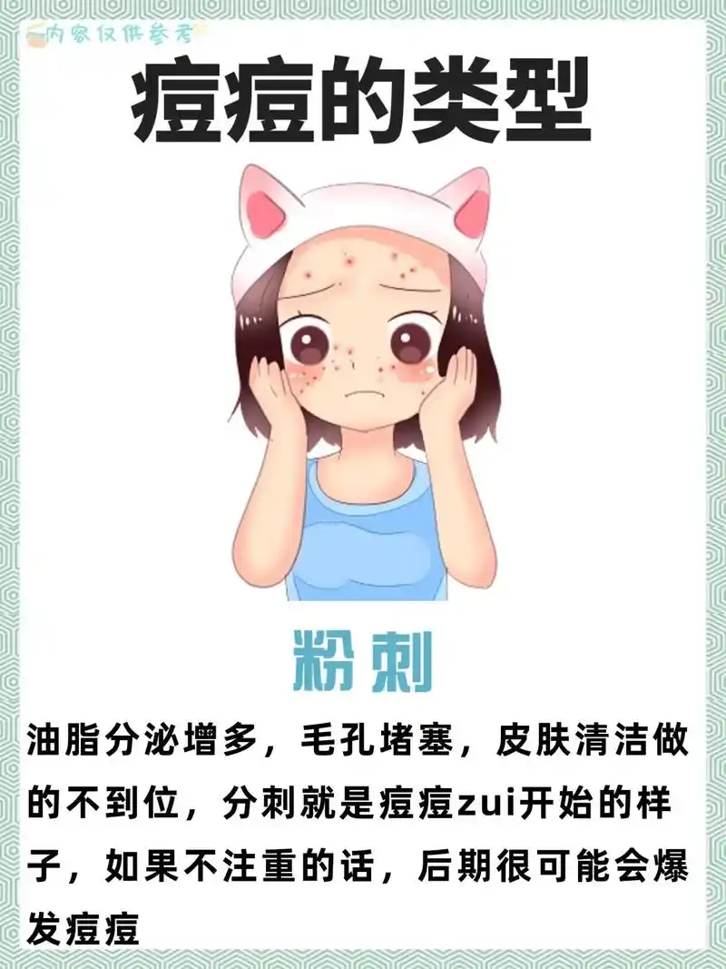 预防和治疗痘痘的方法包括保持良好的面部清洁,避免 - 抖音