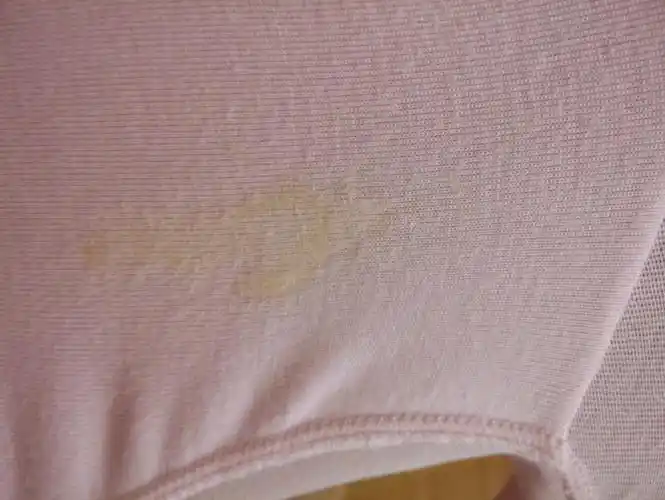 2017-08-08 104 5 28号排卵期同房隔五天后,内裤一直有点点白带,不