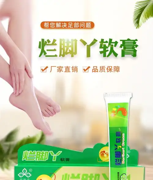 烂脚丫供应新脚气膏去臭脱皮缓解痒痛涂抹软膏草本乳膏抑菌膏