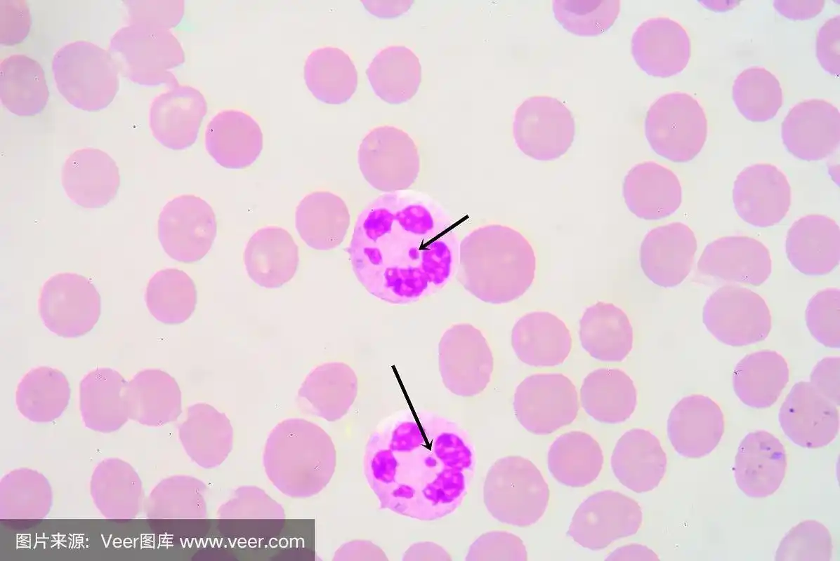 中性粒细胞鸡腿