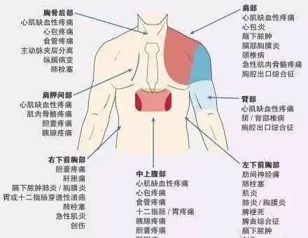 有些人肩背部疼痛查出肺部肿瘤,那么肩背部不适是肺癌的表现吗?