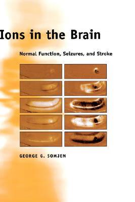 预订 ions in the brain