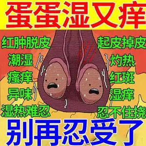 湿疹止痒藓瘙痒阴囊私处男士睾丸下体药膏去大腿根内侧真菌感染zd