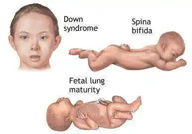 3000不等),检测面窄(不能对全部染色体筛查,目前针对21,18,13三体)