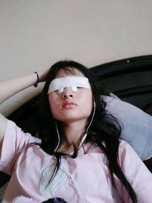 揭开纱布第一天.医生说要一直冰敷