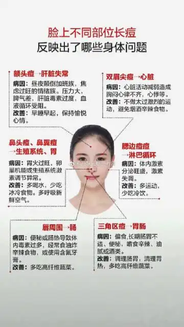 痘痘长在不同位置说明身体不同位置出现问题,你的痘痘长在哪里?
