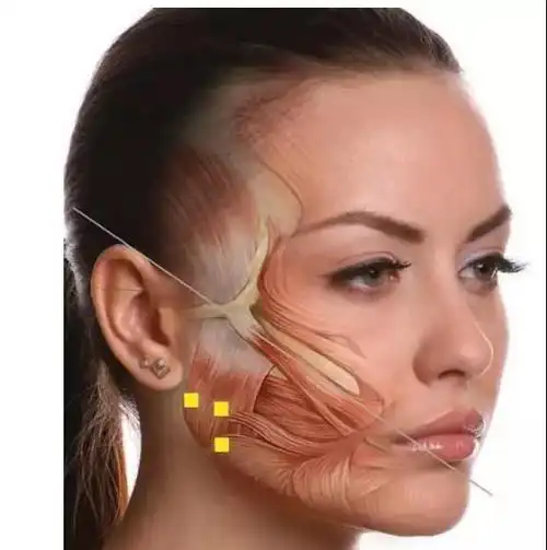 咬肌面部位置图