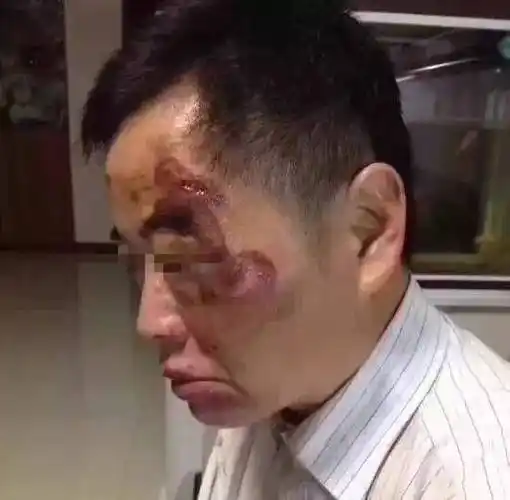 昆山龙哥肠子流了一地(昆山龙哥,扬肠而去)