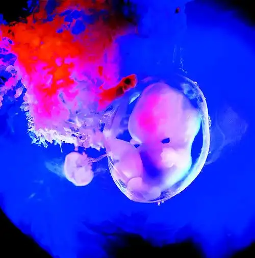 伦纳特尼尔松拍摄的人类胚胎成长照片图