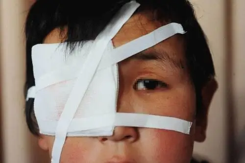 男子抠瞎7岁男童眼因嫌其吵闹警方已刑拘