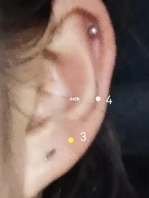 右耳有两个,有个痣,(p1p2)左耳有两个还要再打嘛选一选