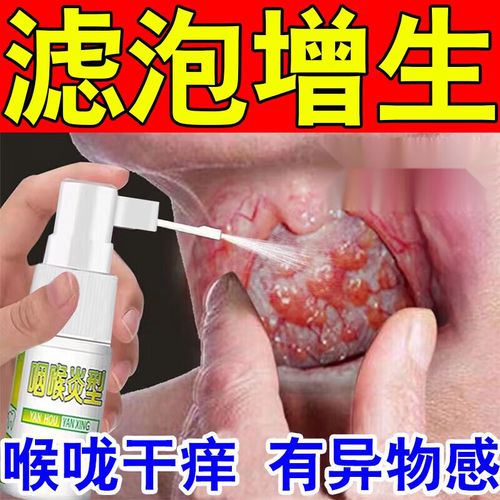 咽喉型医用口腔液体敷料适用于滤泡增生慢性咽炎咽喉壁淋巴滤泡增生