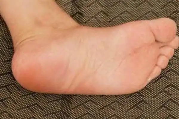 有以下4种脚型的女人福泽深厚一出生就是富贵命特别是第二种