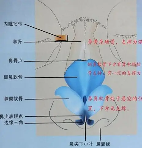 鼻翼软骨是不能被压的,l型假体不科学