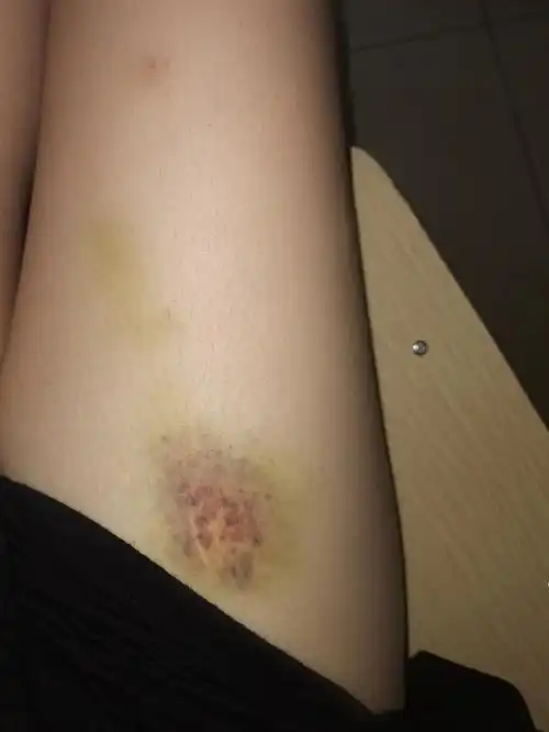 回应: 救救孩子,有姐妹有腿受伤的照片吗?