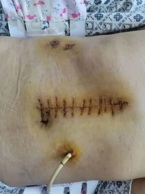 市四院外二科8月复工复产录