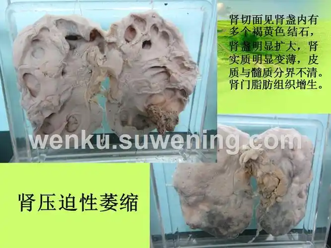 病理学大体标本