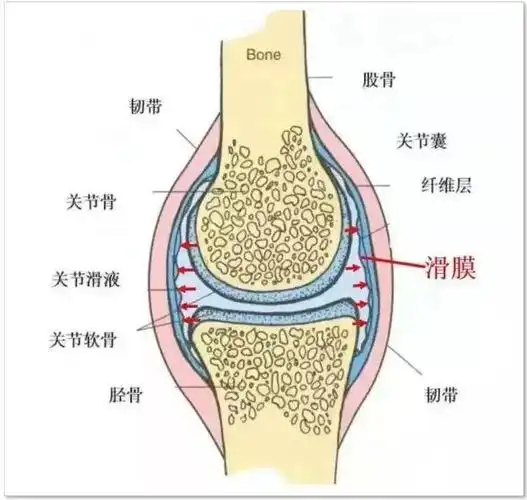 不是所有的膝盖疼痛都是滑膜炎