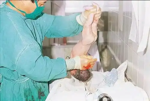 图解真实自然分娩全过程胆小者勿入