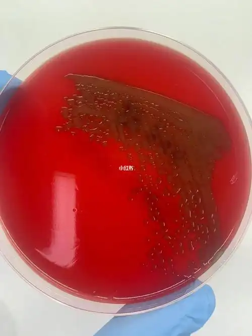 [向右r]黏液性肺炎链球菌在荚膜的外面又包裹了一层黏液,双重保护.