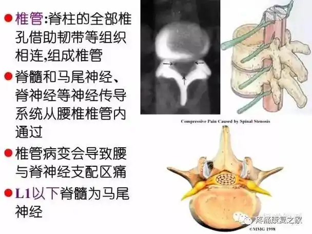 回顾最新详细的腰椎间孔解剖腰椎微创手术必备知识点