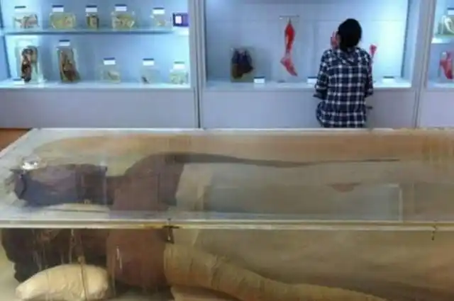 她是中国第一女巨人,14岁身高超过姚明,去世后遗体为何保存38年