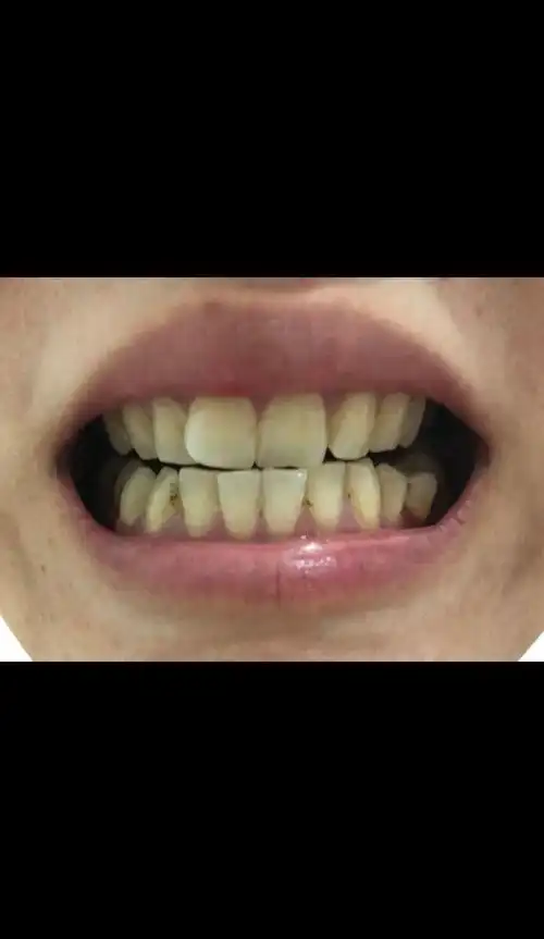 牙齿没有光泽,牙菌斑多,看看吧