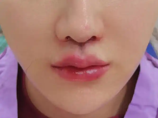 幼态短人中案例#整形医生案例大赏