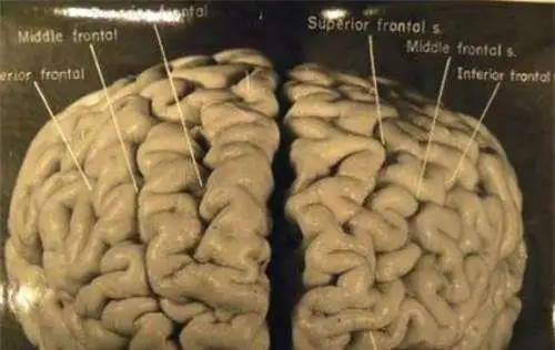 爱因斯坦死后,大脑被人研究,这才发现"天才"的秘密