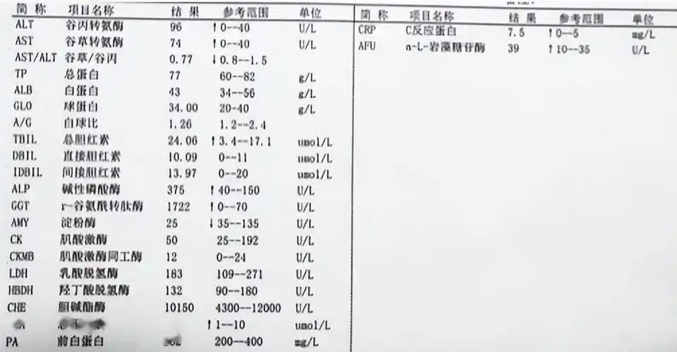 如何初步自我判断肝功能化验单教你一个方法只需要看懂3点