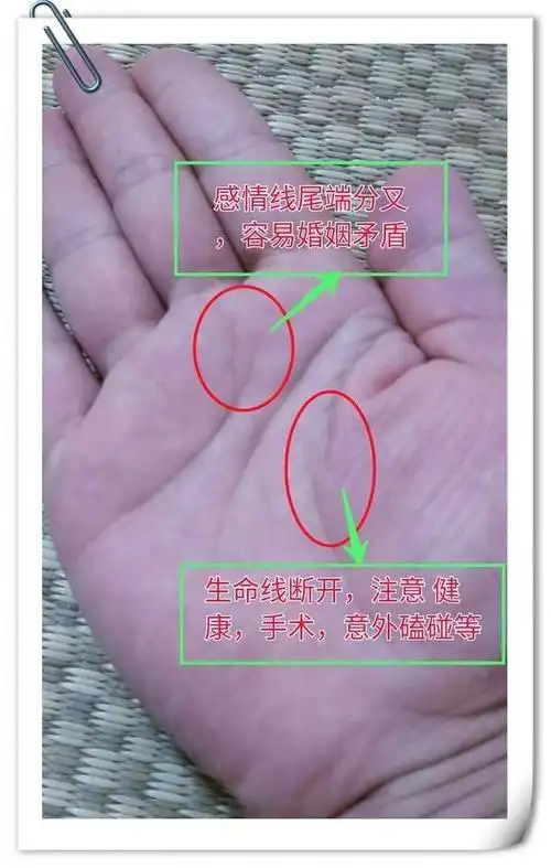 生命线怕断开,手相中生命线中间断开的人,容易经历手术,意外等问题