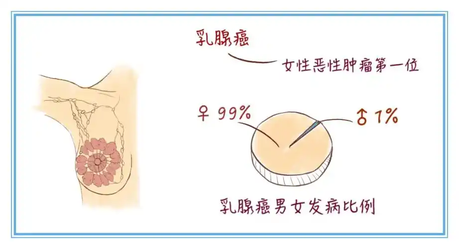 皮肤改变:乳腺癌通过累计cooper韧带引起皮肤凹陷,即俗称的酒窝征;当